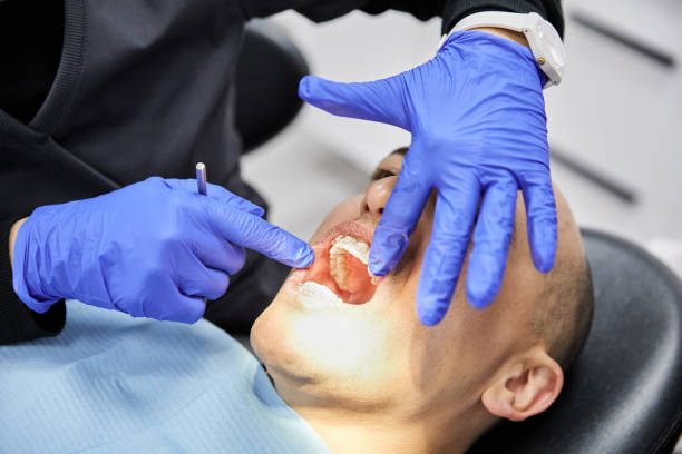 Best Emergency Dental Extractions in Port Angeles East, WA